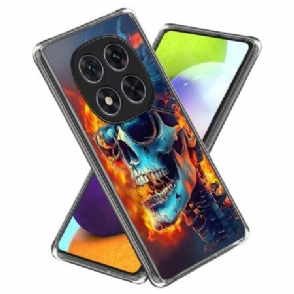 Hoesje Voor Xiaomi Redmi Note 14 Pro 4g Vlammende Schedel
